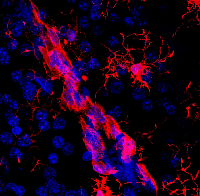 人肺鳞癌细胞SK-MES-1