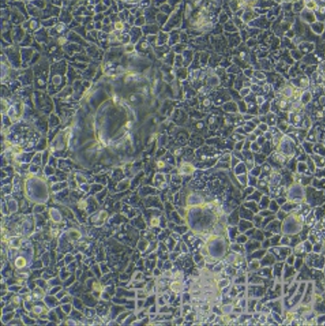 CACO-2-LUC-RFP（人结直肠腺癌细胞-红色荧光蛋白-荧光素酶标记）YB-71050HC-LR