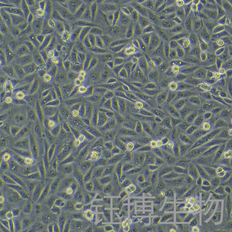 CADO-ES1（人尤文氏肉瘤细胞）YB-75689HC