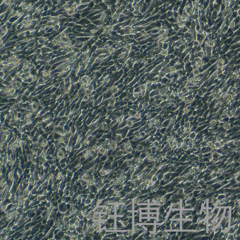 CT-2A（小鼠胶质母细胞瘤细胞）YB-75705MC