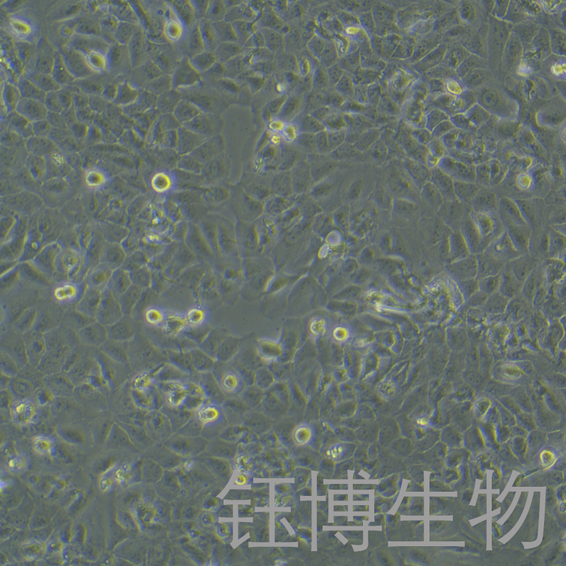 DOK（人口腔黏膜癌前病变细胞）YB-75707HC