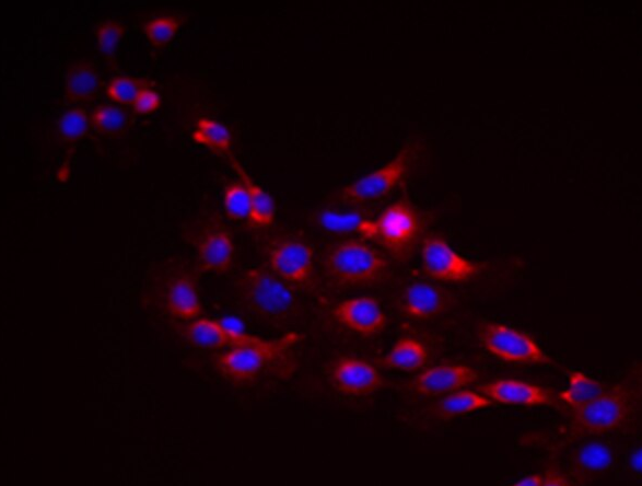Calu-3 人肺腺癌细胞胸水