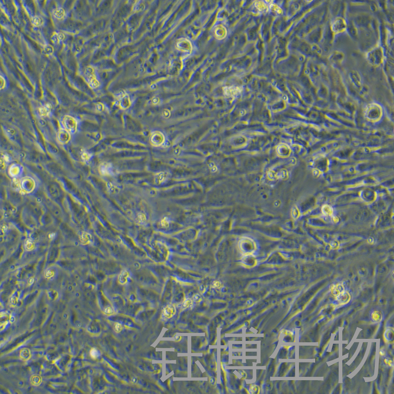 HBVP（人脑血管周细胞）YB-75726HC