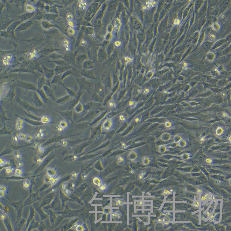 HASMC（人主动脉平滑肌细胞）YB-75725HC