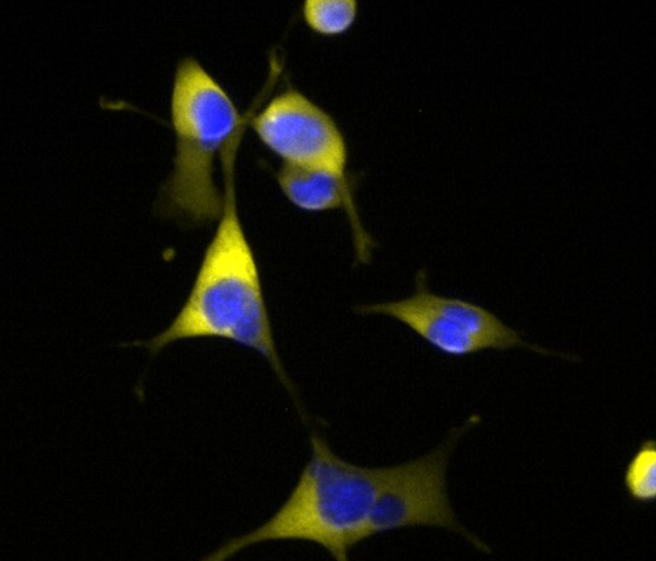 人食管癌细胞TE-7