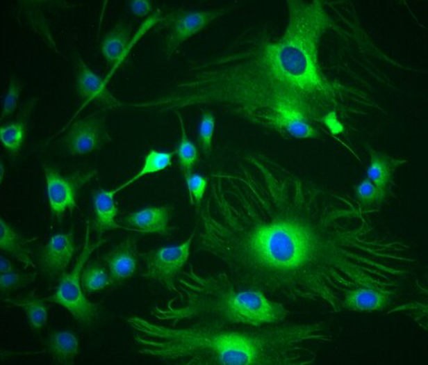 Y3-Ag 1.2.3 大鼠骨髓瘤细胞