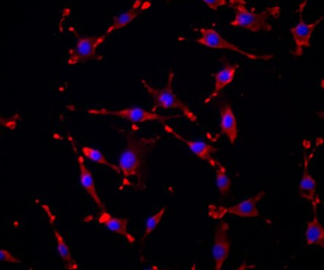 NCI-H1975 人肺腺癌细胞