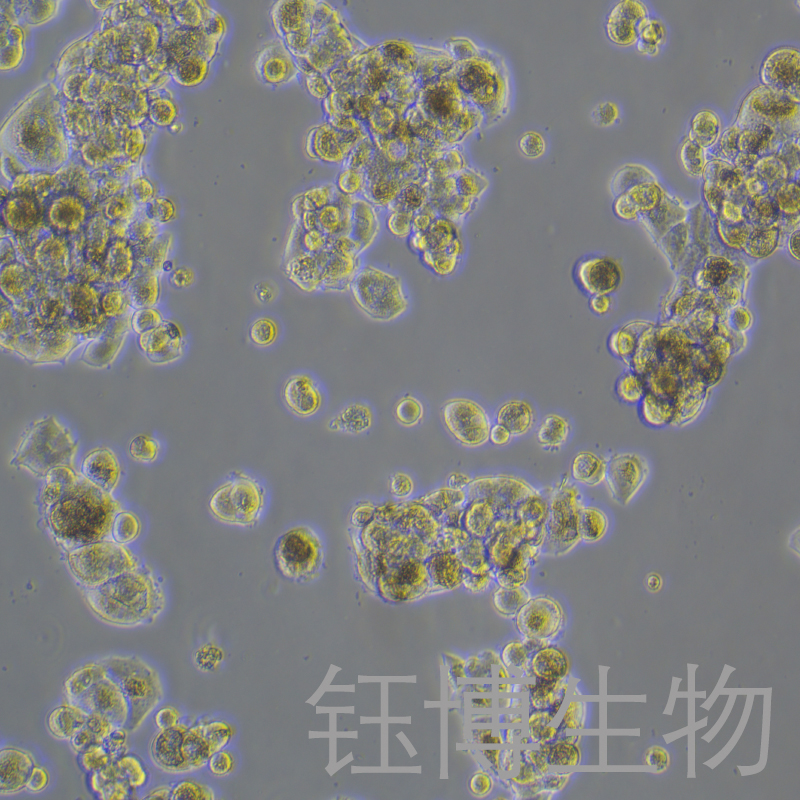 HCC1419（乳腺癌细胞）YB-75728HC