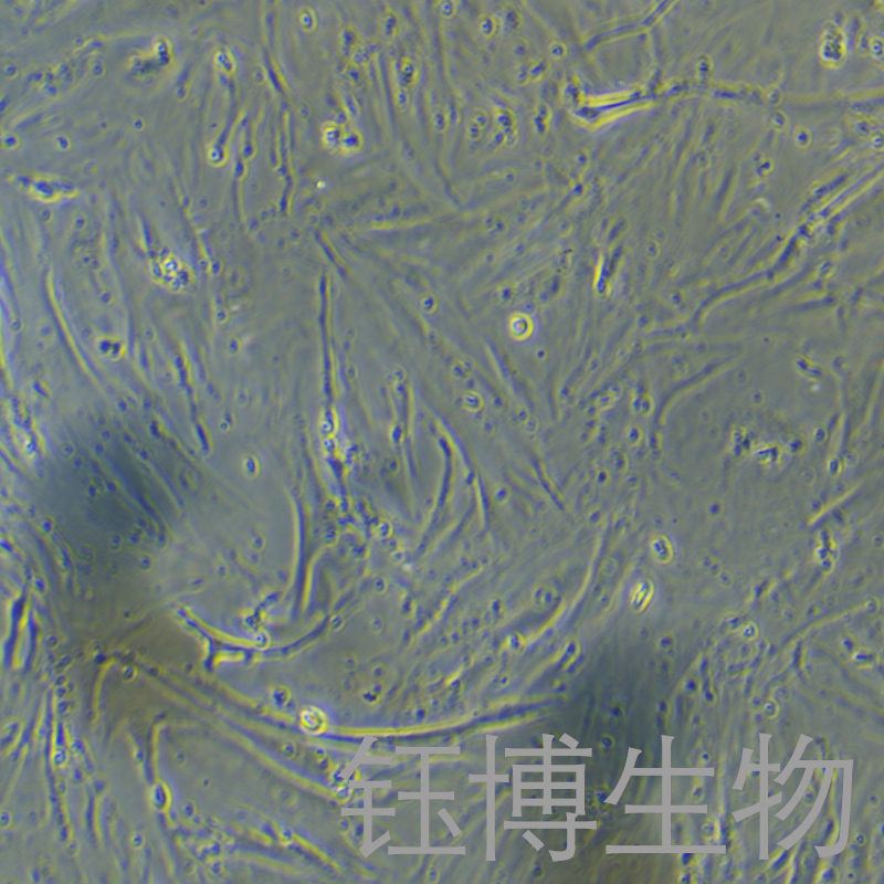 HCF（人心脏成纤维细胞）YB-75731HC