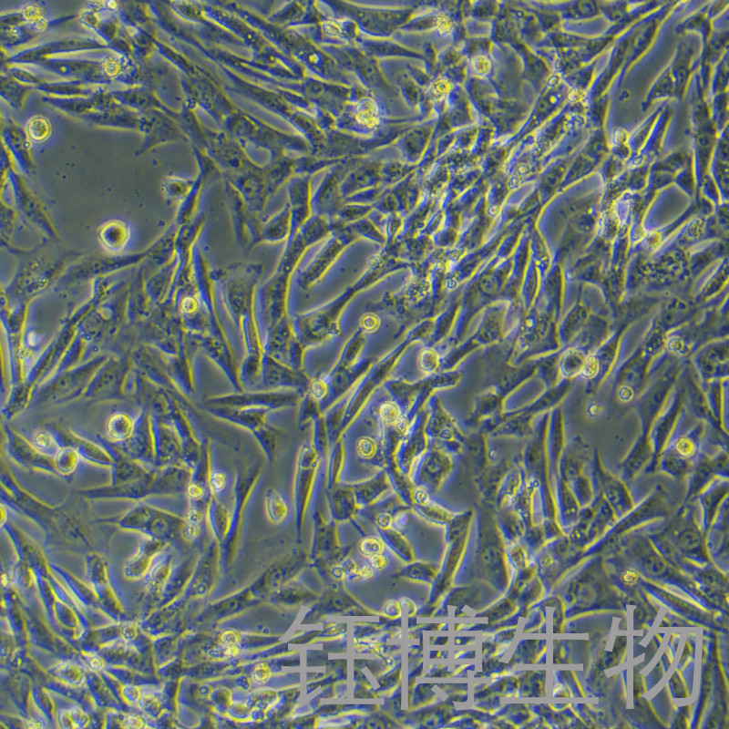 HDF-a（人皮肤成纤维细胞）YB-75734HC