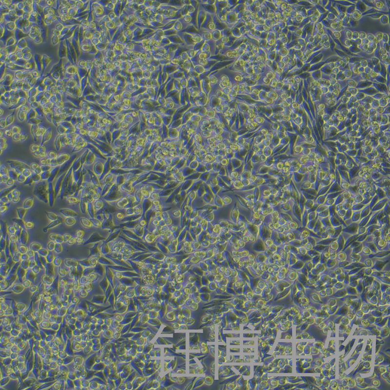 HD-11（鸡巨噬细胞）YB-75733OC