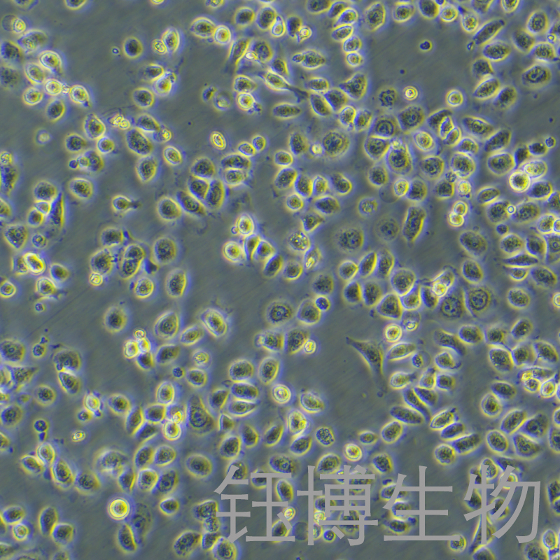 HEEC（人正常食管上皮细胞）YB-75735HC