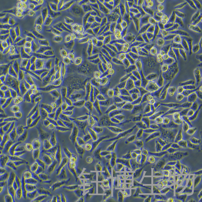 Hela-GFP（人宫颈癌细胞带绿色荧光）YB-71101HC-G