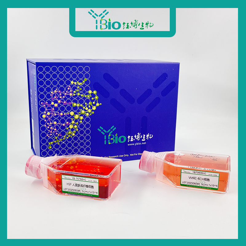 Hep 3B2.1-7-LUC（人肝癌细胞-荧光素酶标记）YB-71102HC-L