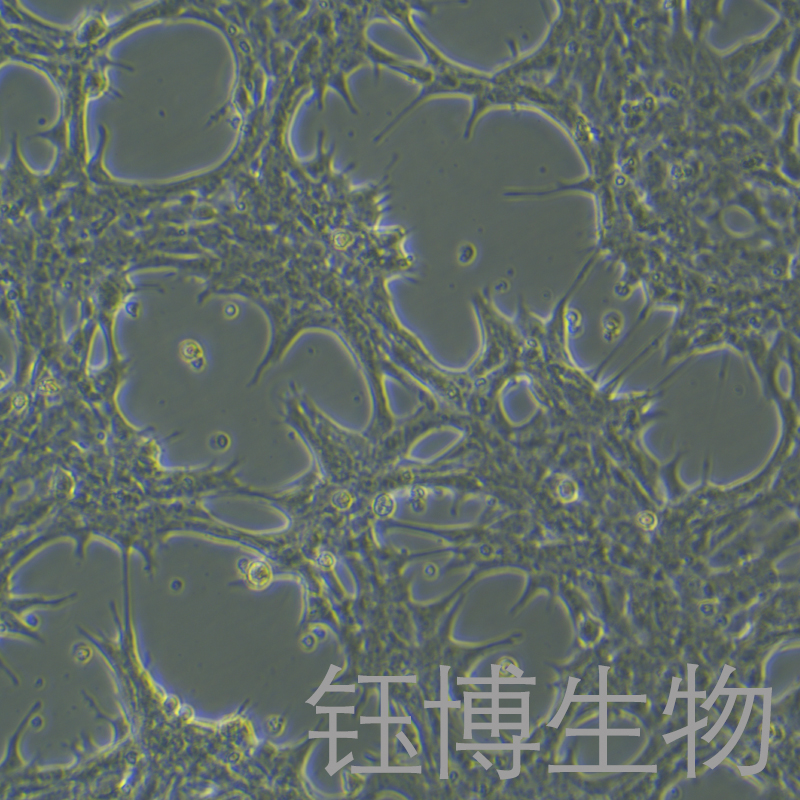 hep53.4（小鼠肝癌细胞）YB-75743MC