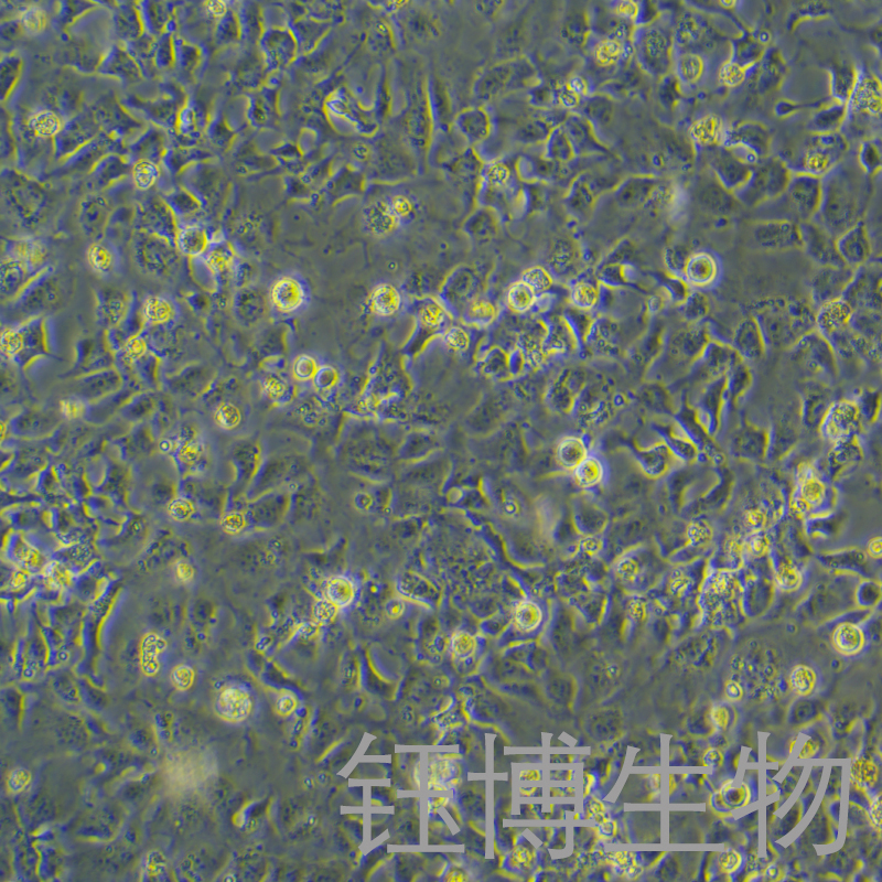 Hep3B（人肝癌细胞）YB-75742HC