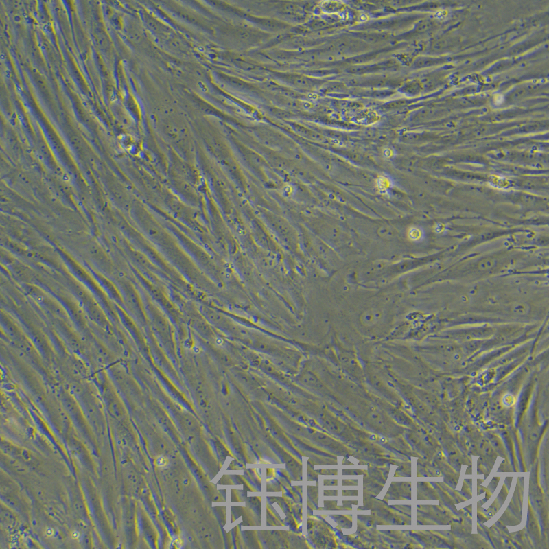 HGF（人牙龈成纤维细胞）YB-75748HC