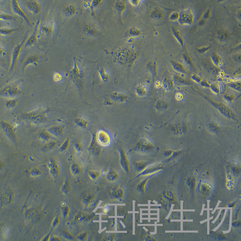 HLEC（人晶状体上皮细胞）YB-75753HC