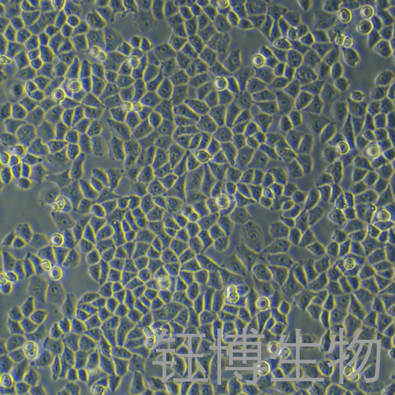 HOK（人正常口腔角质细胞）YB-75759HC