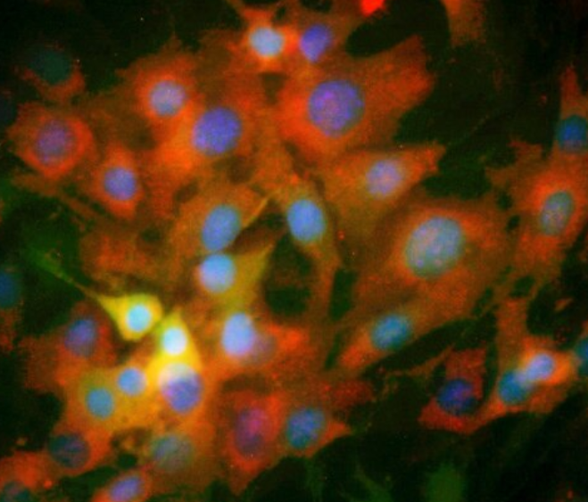 HEC-1-A 人子宫内膜腺癌细胞