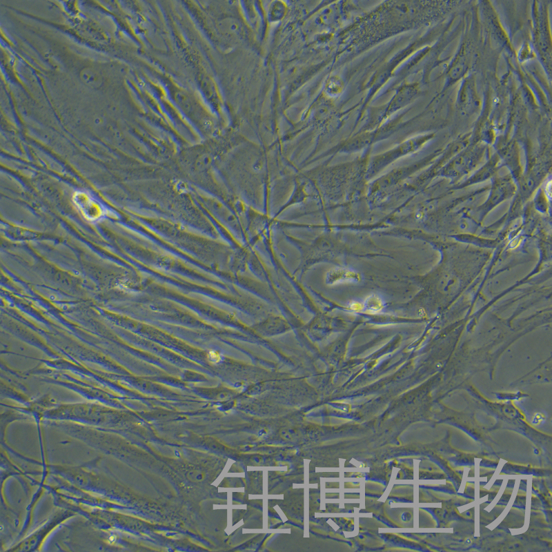Hs888Lu（人肺成纤维细胞）YB-75765HC