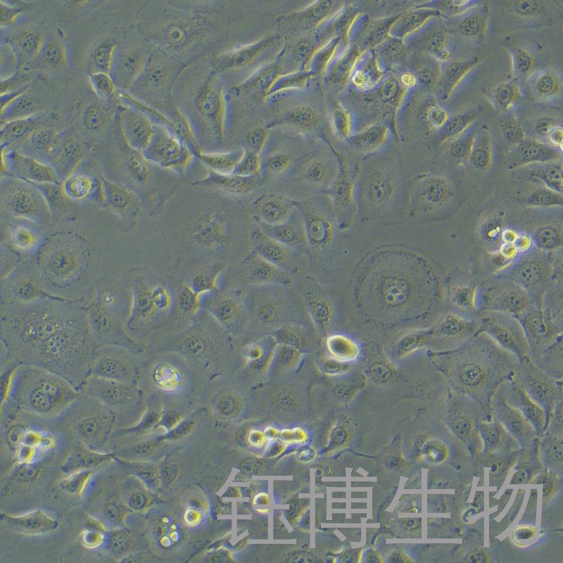 HSC-2（人口腔鳞状肿瘤细胞）YB-75766HC
