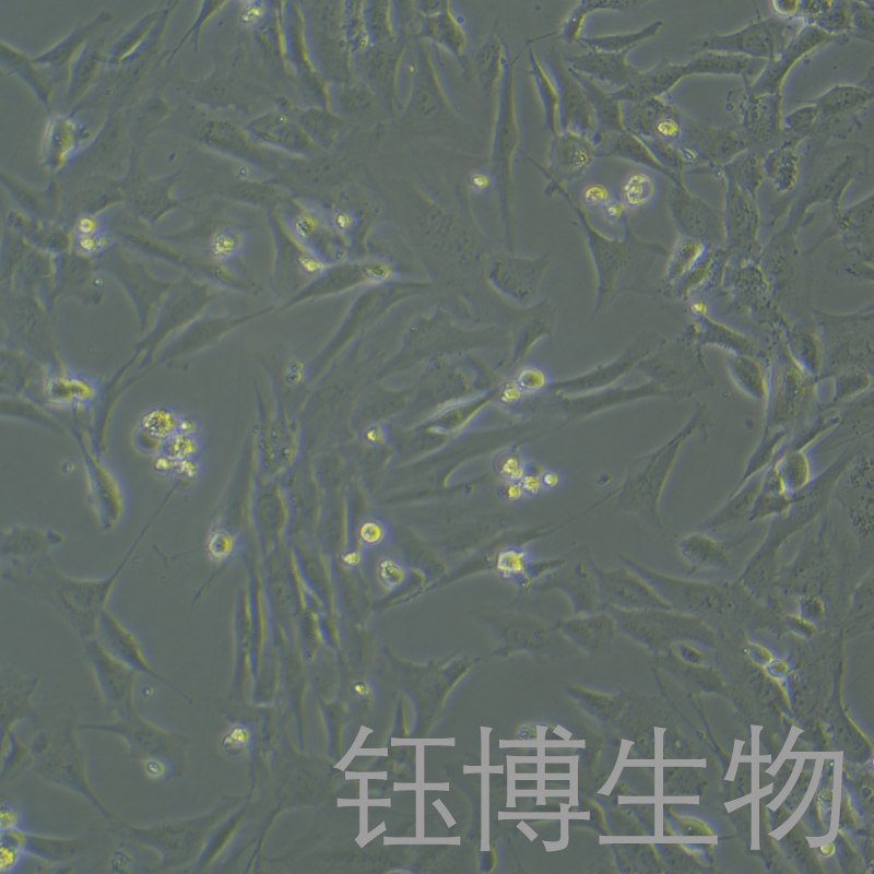 HSF（人皮肤成纤维细胞）YB-75768HC