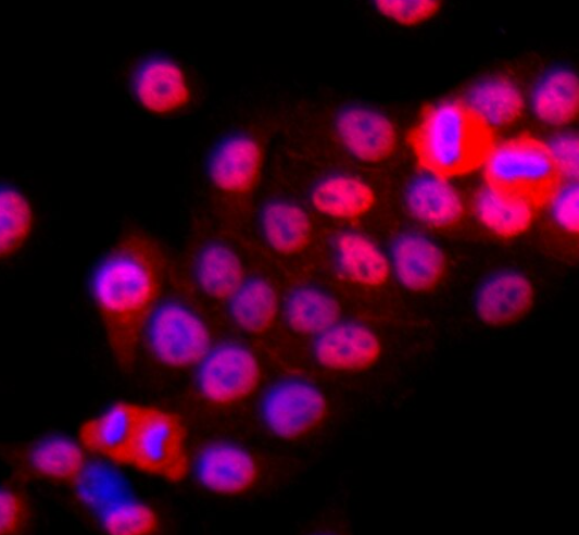 NCI-H295R 人肾上腺皮质腺癌细胞