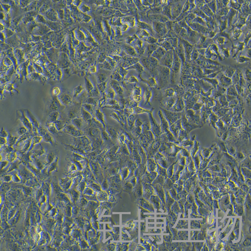 Huh-7 sorafenib（人肝癌索拉非尼耐药株）YB-71120HCR2