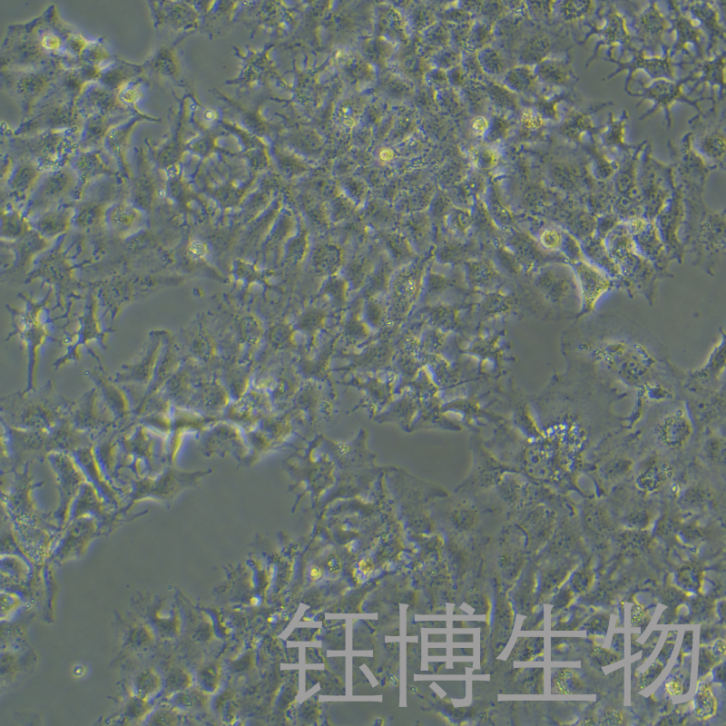 HUH7/Lenvatinib（人肝癌乐伐替尼耐药株）YB-71120HCR