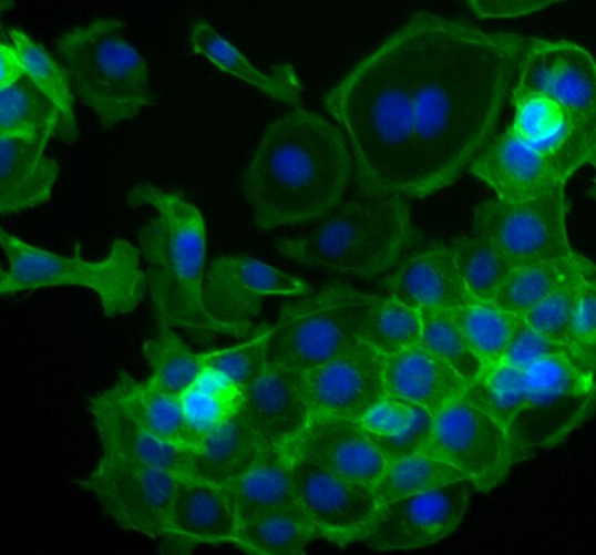 WPMY-1 人正常前列腺基质永生化细胞
