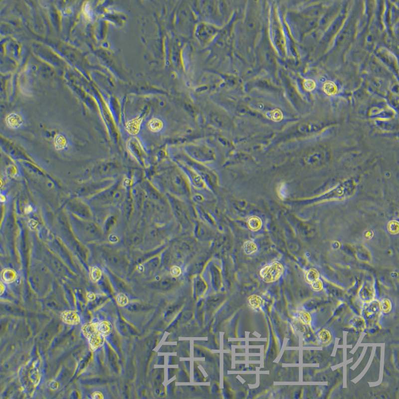 JHH-6（肝细胞癌细胞）YB-75777HC