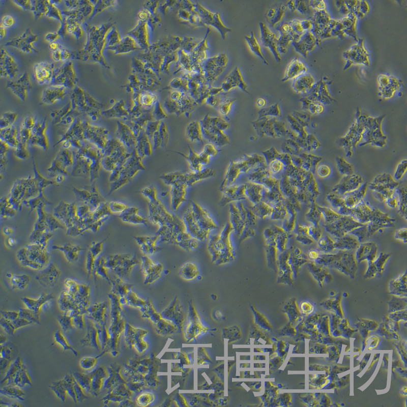 Kelly（神经母细胞瘤）YB-75781HC