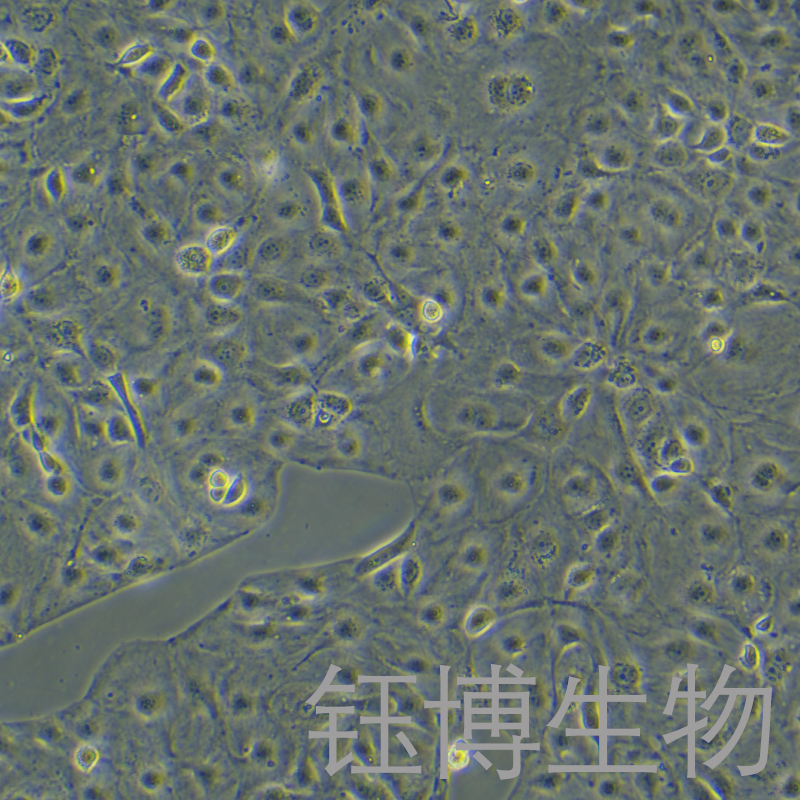 KURAMOCHI（人卵巢癌细胞）YB-75787HC