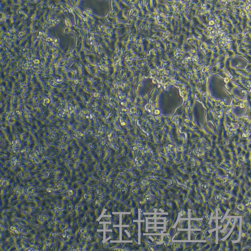 LLC-GFP（小鼠肺癌细胞带绿色荧光）YB-72140MC-G