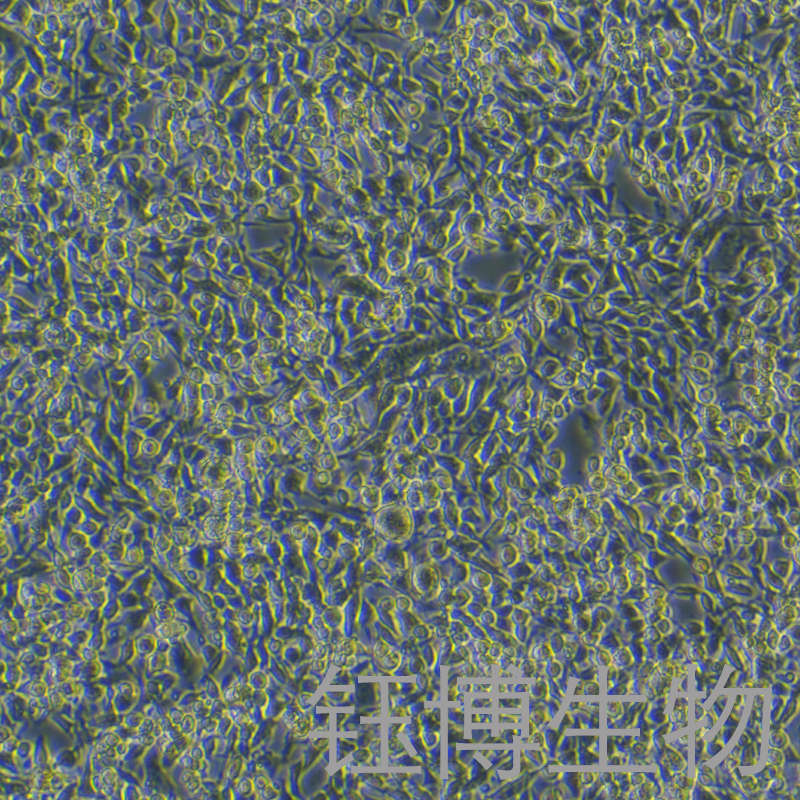 MB49-LUC（小鼠膀胱癌细胞-荧光素酶标记）YB-7034MC-L