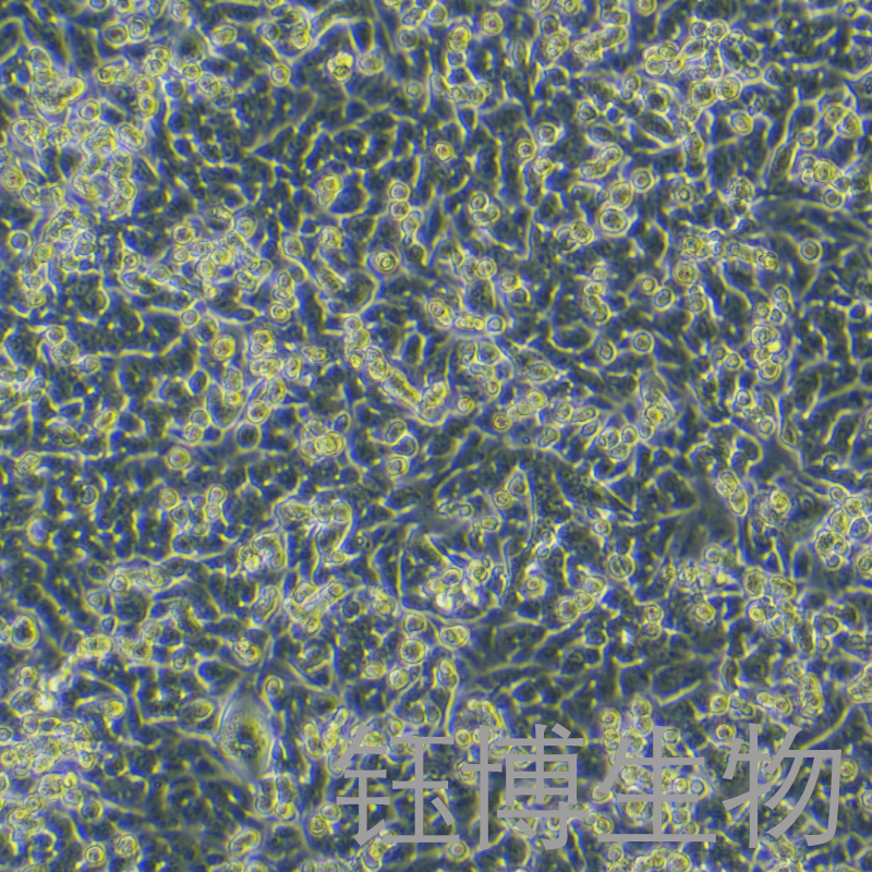 MBT-2-luc（小鼠膀胱癌细胞-荧光素酶标记）YB-7035MC-L