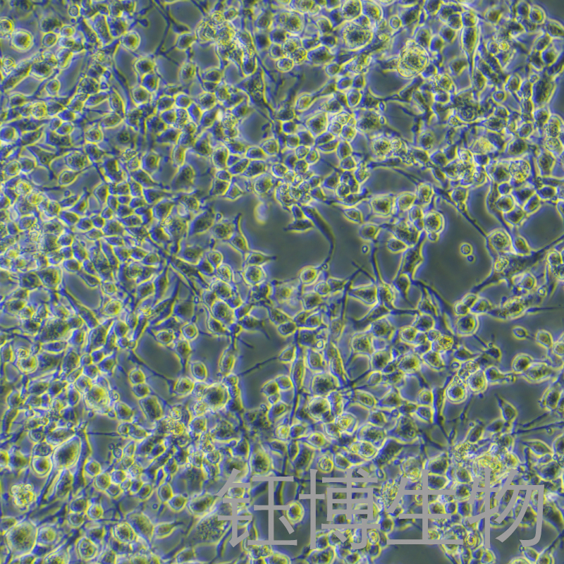 MC38-OVA-LUC（小鼠结肠癌细胞株转染）YB-72479MC-OL