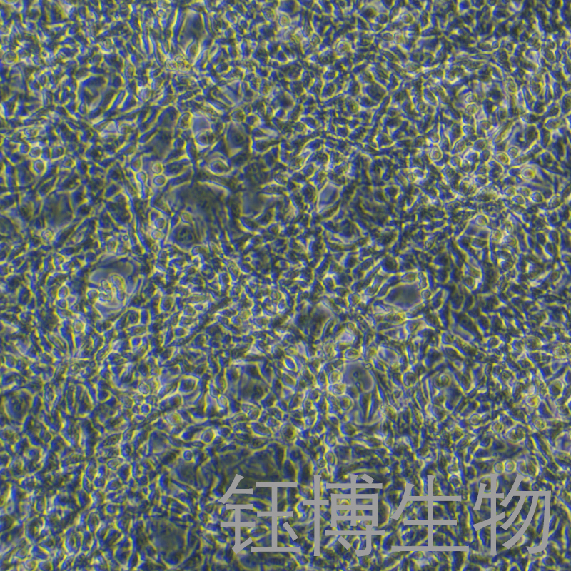 MC38（小鼠结肠癌细胞）YB-72479MC