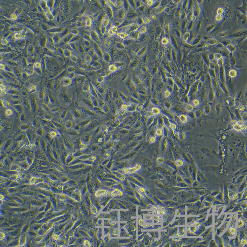 MDA-MB-231/DDP-GFP（人乳腺癌顺铂耐药株）YB-71150HCR-G