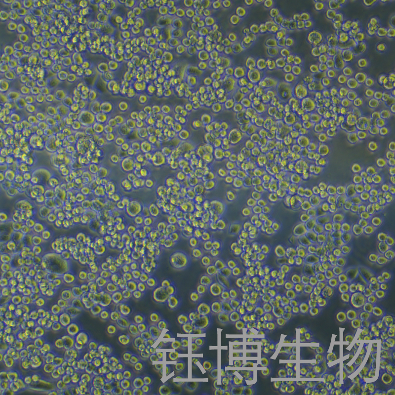 MDA-MB-453-LUC（人乳腺癌细胞-荧光素酶标记）YB-71152HC-L