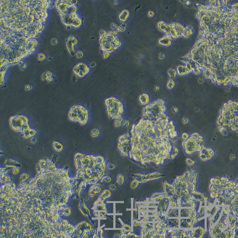 MDA-PCA-2B（人前列腺癌细胞）YB-75808HC