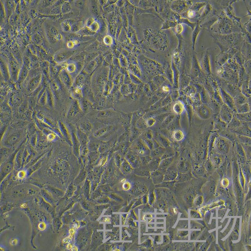 MH7A（人正常关节滑膜成纤维细胞）YB-75813HC