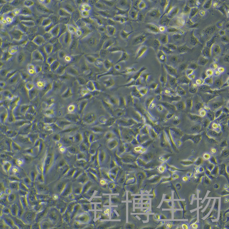 moc1（小鼠口腔鳞状细胞癌）YB-75820MC