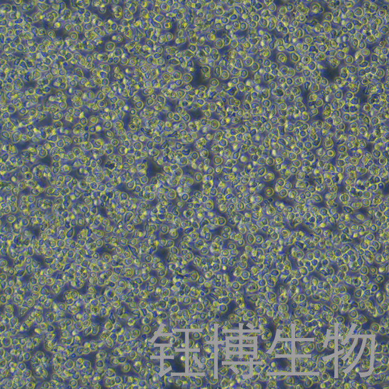 NB2-11（大鼠淋巴瘤细胞）YB-75826RC