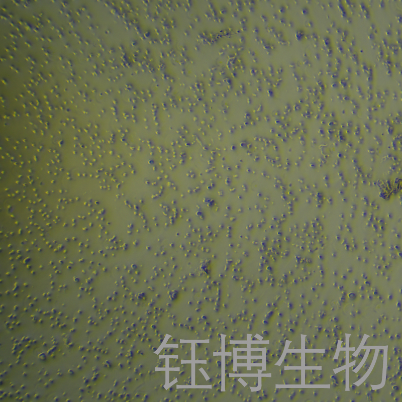 NALM-6-LUC（人B淋巴白血病细胞-荧光素酶标记）YB-71782HC-L