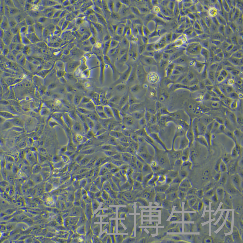 MDCK [NBL-2]（犬肾细胞）YB-75825OC
