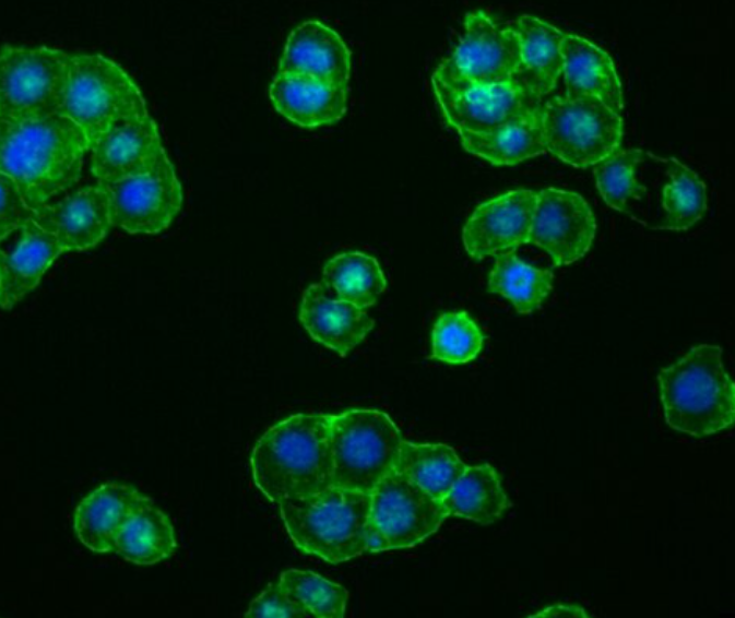 NCI-H441 人肺腺癌细胞