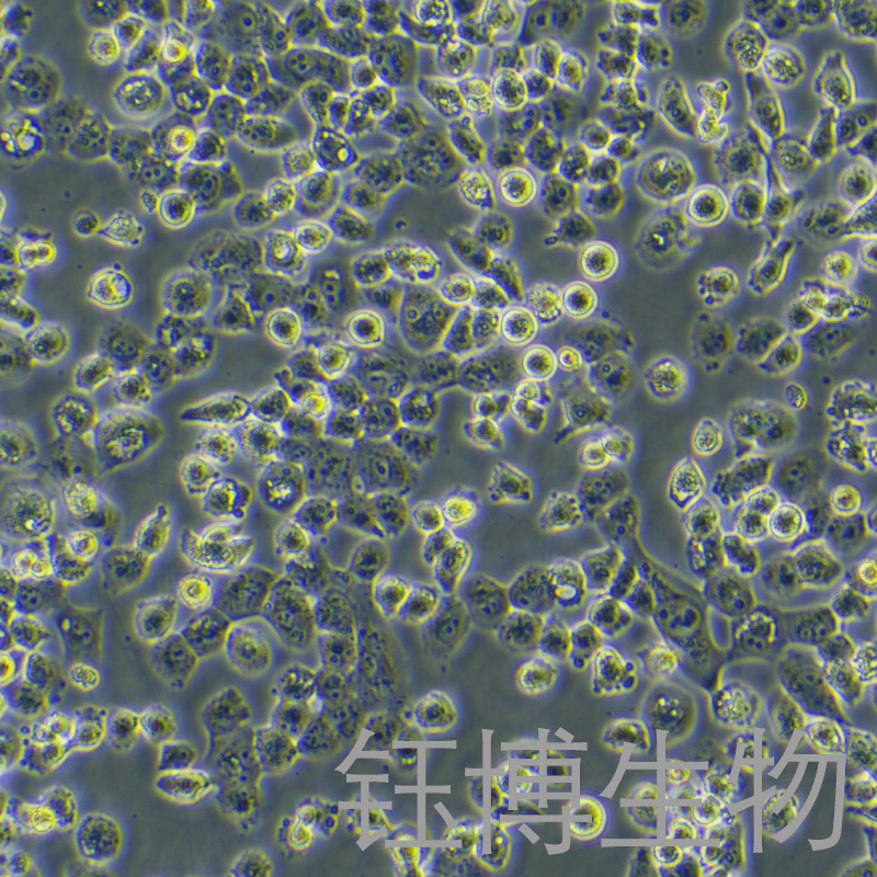 NCI-H1299-GFP（人肺癌细胞（包括非小细胞肺癌）（GFP标记））YB-71165HC-G