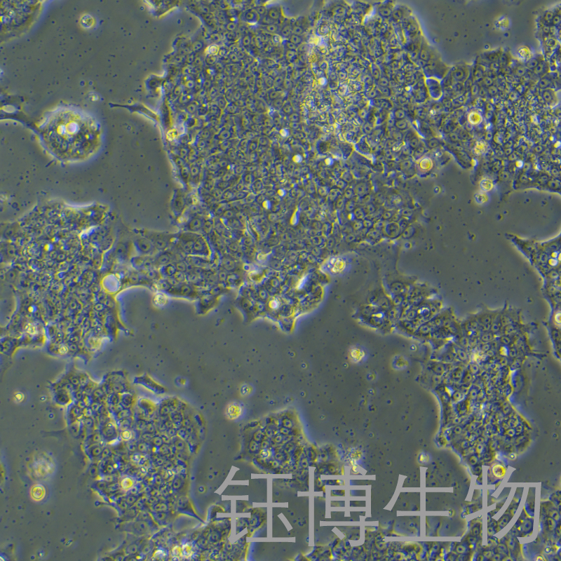 NCI-H1435（人肺腺癌细胞）YB-75829HC